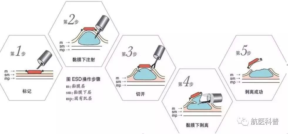 微信(xin)圖片_20191122100720.jpg 微信(xin)圖片_20191122100720.jpg